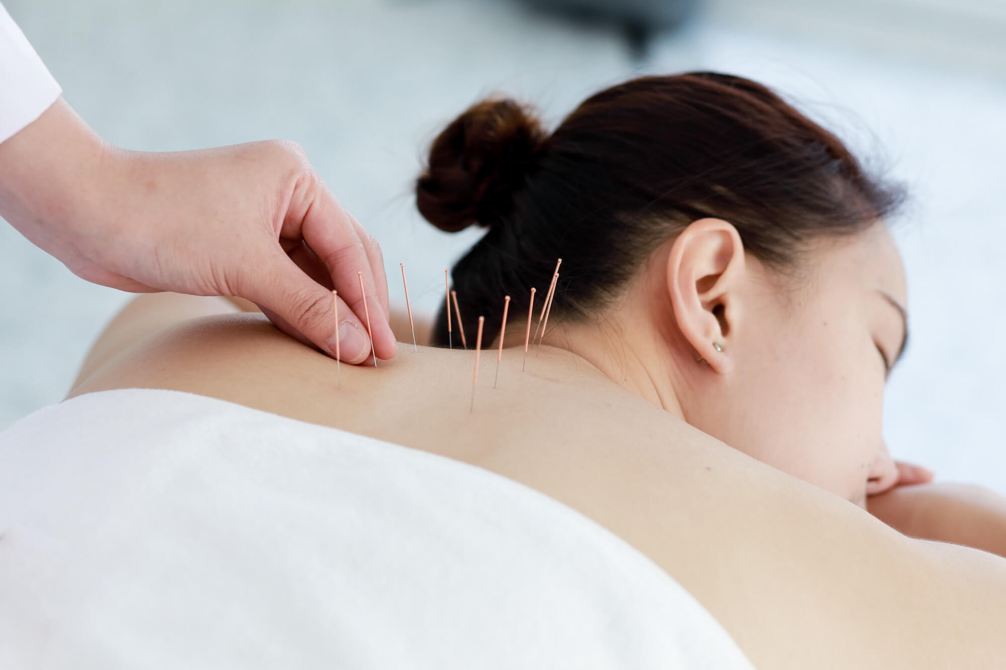Acupuncturist in Menifee, CA